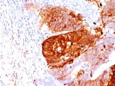Immunohistochemistry-Paraffin: Aldehyde Dehydrogenase 1-A1/ALDH1A1 Antibody (ALDH1A1/1381) [NBP2-53248]