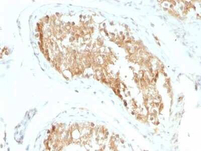 Immunohistochemistry-Paraffin: Aldehyde Dehydrogenase 1-A1/ALDH1A1 Antibody (ALDH1A1/1381) [NBP2-53248]