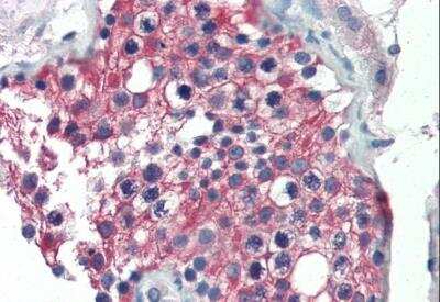 Immunohistochemistry-Paraffin: Aldehyde Dehydrogenase 1-A1/ALDH1A1 Antibody [NB100-2563]