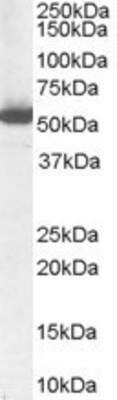 Western Blot: Aldehyde Dehydrogenase 1-A1/ALDH1A1 Antibody [NB100-2563]