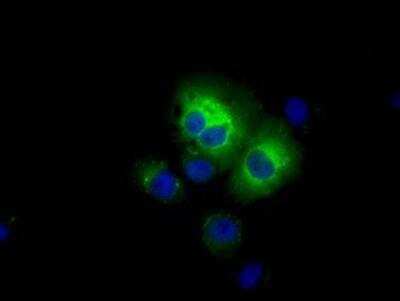Immunocytochemistry/ Immunofluorescence: Aldehyde Dehydrogenase 3-A1/ALDH3A1 Antibody (OTI1B6) [NBP2-02483]