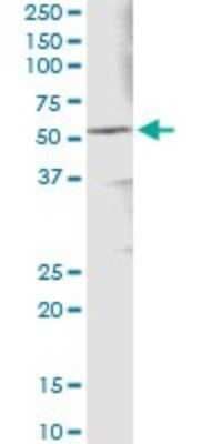 Immunoprecipitation: Aldehyde Dehydrogenase 3-A1/ALDH3A1 Antibody (2G4) [H00000218-M08]