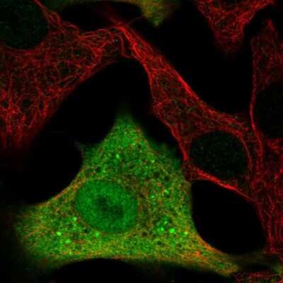 Immunocytochemistry/ Immunofluorescence: Aldehyde Dehydrogenase 3-A1/ALDH3A1 Antibody [NBP2-55797]