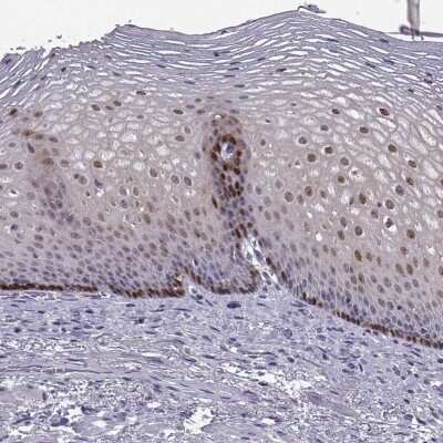Immunohistochemistry-Paraffin: Aldehyde Dehydrogenase 3-A1/ALDH3A1 Antibody [NBP2-55797]