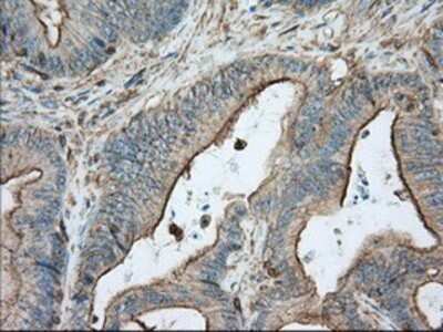 Immunohistochemistry: Aldehyde Dehydrogenase 3-A1/ALDH3A1 Antibody (OTI1B6) - Azide and BSA Free [NBP2-70152]