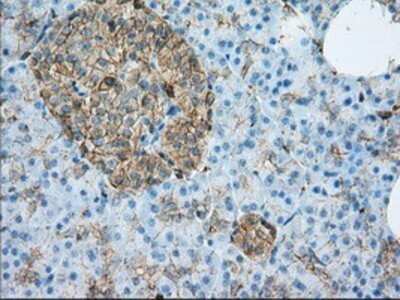 Immunohistochemistry: Aldehyde Dehydrogenase 3-A1/ALDH3A1 Antibody (OTI1B6) - Azide and BSA Free [NBP2-70152]