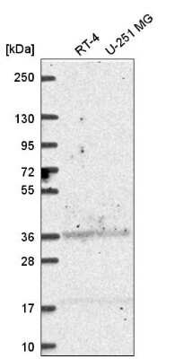 Western Blot: Aldehyde Dehydrogenase 3-A1/ALDH3A1 Antibody [NBP2-55797]
