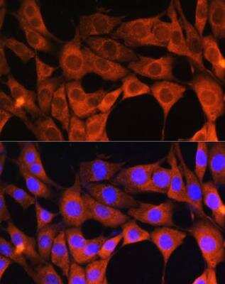 Immunocytochemistry/ Immunofluorescence: Aldehyde Oxidase 1/AOX1 Antibody - BSA Free [NBP2-92428]