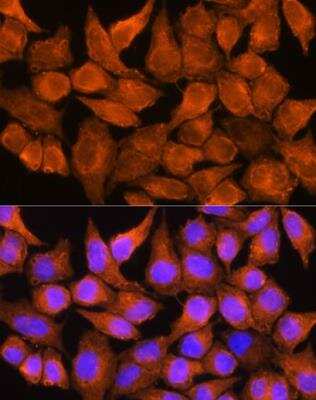 Immunocytochemistry/ Immunofluorescence: Aldehyde Oxidase 1/AOX1 Antibody - BSA Free [NBP2-92428]