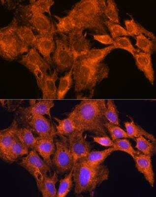 Immunocytochemistry/ Immunofluorescence: Aldehyde Oxidase 1/AOX1 Antibody - BSA Free [NBP2-92428]