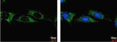 Immunocytochemistry/ Immunofluorescence: Aldehyde dehydrogenase 5 Antibody [NBP1-32569]