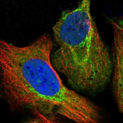 Immunocytochemistry/ Immunofluorescence: Aldehyde dehydrogenase 5 Antibody [NBP1-90192]