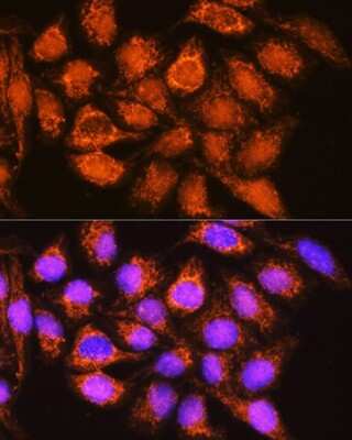 Immunocytochemistry/ Immunofluorescence: Aldehyde dehydrogenase 5 Antibody - BSA Free [NBP2-92430]
