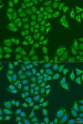 Immunocytochemistry/ Immunofluorescence: Aldehyde dehydrogenase 5 Antibody - BSA Free [NBP2-92625]