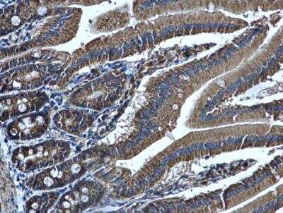 Immunohistochemistry-Paraffin: Aldehyde dehydrogenase 5 Antibody [NBP1-32569]