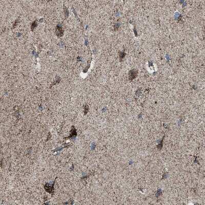 Immunohistochemistry-Paraffin: Aldehyde dehydrogenase 5 Antibody [NBP1-90192]