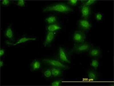 Immunocytochemistry/ Immunofluorescence: Aldo-keto Reductase 1B10/AKR1B10 Antibody (1A6) [H00057016-M01]