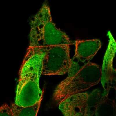 Immunocytochemistry/ Immunofluorescence: Aldo-keto Reductase 1C1/AKR1C1 Antibody [NBP2-57667]