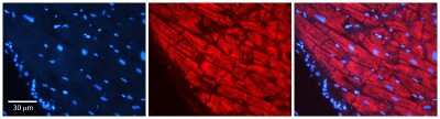 Immunohistochemistry: Aldo-keto Reductase 1C1/AKR1C1 Antibody [NBP1-68877]