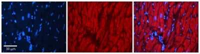 Immunohistochemistry: Aldo-keto Reductase 1C1/AKR1C1 Antibody [NBP1-68878]