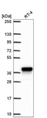 Western Blot: Aldo-keto Reductase 1C1/AKR1C1 Antibody [NBP2-57667]