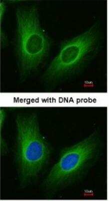 Immunocytochemistry/ Immunofluorescence: Aldo-keto Reductase 1C3/AKR1C3 Antibody [NBP1-31378]