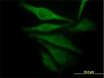 Immunocytochemistry/ Immunofluorescence: Aldo-keto Reductase 1C4/AKR1C4 Antibody (2C11) [H00001109-M01]