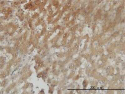 Immunohistochemistry-Paraffin: Aldo-keto Reductase 1C4/AKR1C4 Antibody (2C11) [H00001109-M01]