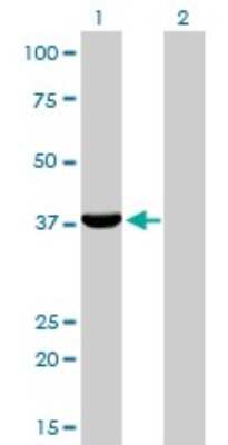 Western Blot: Aldo-keto Reductase 1C4/AKR1C4 Antibody (2C11) [H00001109-M01]