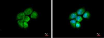 Immunocytochemistry/ Immunofluorescence: Aldo-keto Reductase 1C4/AKR1C4 Antibody [NBP1-31429]