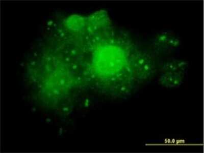 Immunocytochemistry/ Immunofluorescence: Aldolase A Antibody (3C12-6D11) [H00000226-M02]