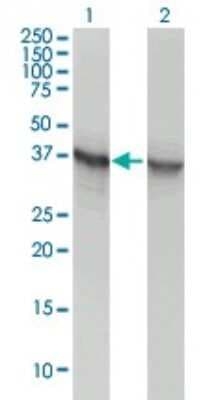Western Blot: Aldolase A Antibody (3C12-6D11) [H00000226-M02]