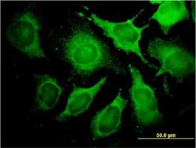 Immunocytochemistry/ Immunofluorescence: Aldolase A Antibody (3D9-6F3) [H00000226-M01]