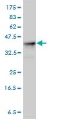 Western Blot: Aldolase A Antibody (3D9-6F3) [H00000226-M01]