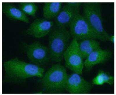 Immunocytochemistry/ Immunofluorescence: Aldolase A Antibody (3F9) - BSA Free [NBP2-42620]