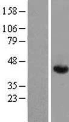 Western Blot: Aldolase A Overexpression Lysate [NBL1-07461]