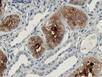 Immunohistochemistry: Aldolase B Antibody (OTI3C6) - Azide and BSA Free [NBP2-70162]