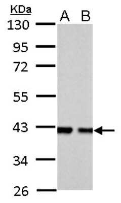 Western Blot: Aldolase B Antibody [NBP2-15345]