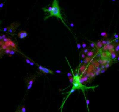 Immunocytochemistry/ Immunofluorescence: Aldolase C Antibody (1A1) [NBP2-25144]