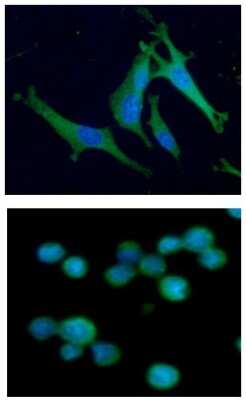 Immunocytochemistry/ Immunofluorescence: Aldolase C Antibody (2E11) - BSA Free [NBP2-59408]