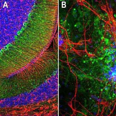 Immunocytochemistry/ Immunofluorescence: Aldolase C Antibody (4A9) [NBP2-25145]