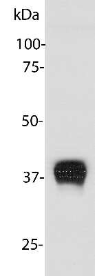 Western Blot: Aldolase C Antibody (E9) [NBP2-50056]