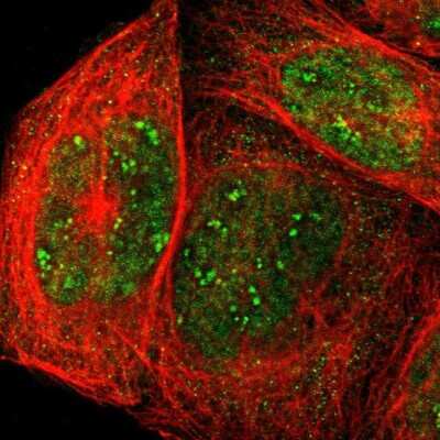Immunocytochemistry/ Immunofluorescence: Aldolase C Antibody [NBP1-90954]
