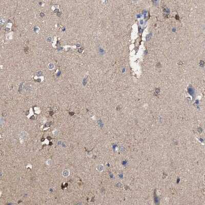 Immunohistochemistry-Paraffin: Aldolase C Antibody [NBP1-90954]