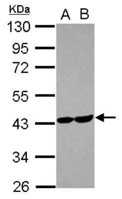 Western Blot: Aldolase C Antibody [NBP2-15346]