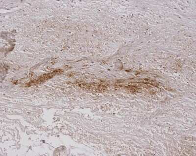 Immunohistochemistry: Alginate Antibody (4B10-1C5) [NBP2-59348]