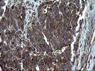 Immunohistochemistry: Alix Antibody (OTI1A4) [NBP2-46348]