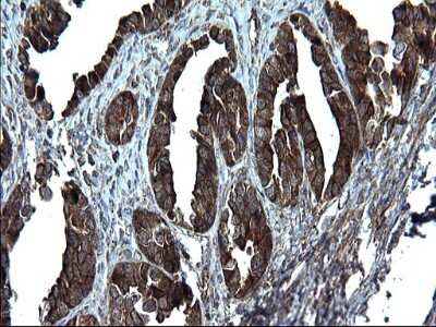 Immunohistochemistry: Alix Antibody (OTI1A4) [NBP2-46348]