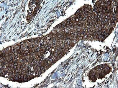 Immunohistochemistry: Alix Antibody (OTI1A4) - Azide and BSA Free [NBP2-71537]
