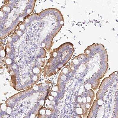 Immunohistochemistry: Alkaline Phosphatase, Intestinal Antibody [NBP2-34057]